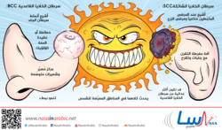 كارسينوما الخلايا القاعدية-كارسينوما الخلايا الشائكة