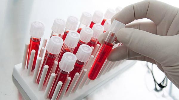 طفرة علمية لمكافحة السرطان.. فحص دم يكشف 50 نوعا قبل أعراضه