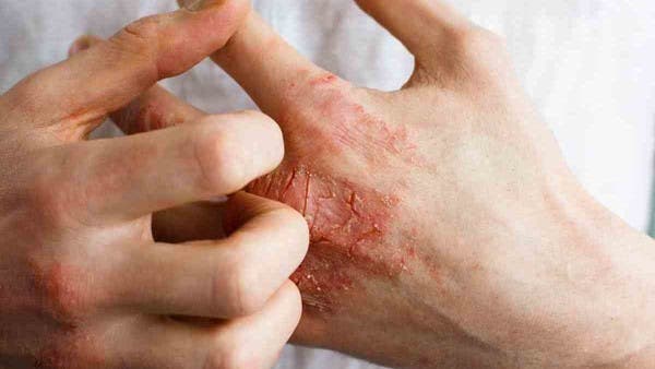 كيف يمكننا وقاية الجلد من الأمراض في زمن كورونا؟