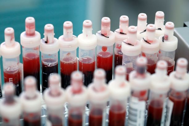 هل بلازما الدم فعالة لعلاج كورونا؟ دراسة بريطانية تجيب