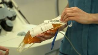 فيروس كورونا: آلاف البريطانيين يشاركون بتجربة العلاج بحقن بلازما من دم متعافين