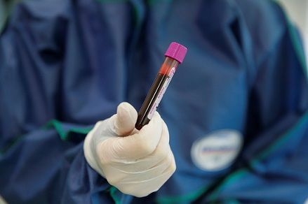 تسجيل 213 إصابة جديدة بفيروس كورونا في ألمانيا