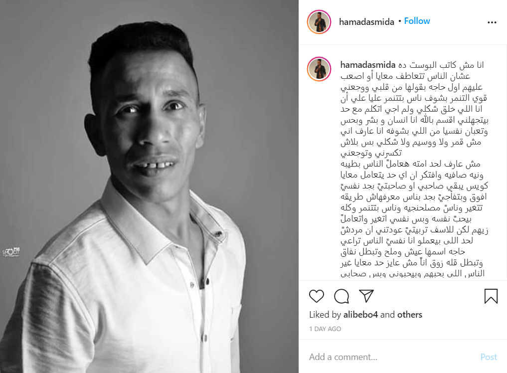 فنان مصري يشكو من التنمر: تعبان نفسياً أعرف أني لست وسيماً