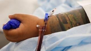 فيروس كورونا: الولايات المتحدة ترخّص استخدام بلازما الدم من المتعافين لعلاج كوفيد-19 في الحالات الطارئة
