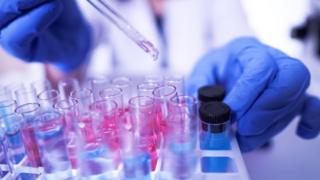 فيروس كورونا: باحثون في بريطانيا يحذرون من خطر الاعتماد على اختبارات الأجسام المضادة