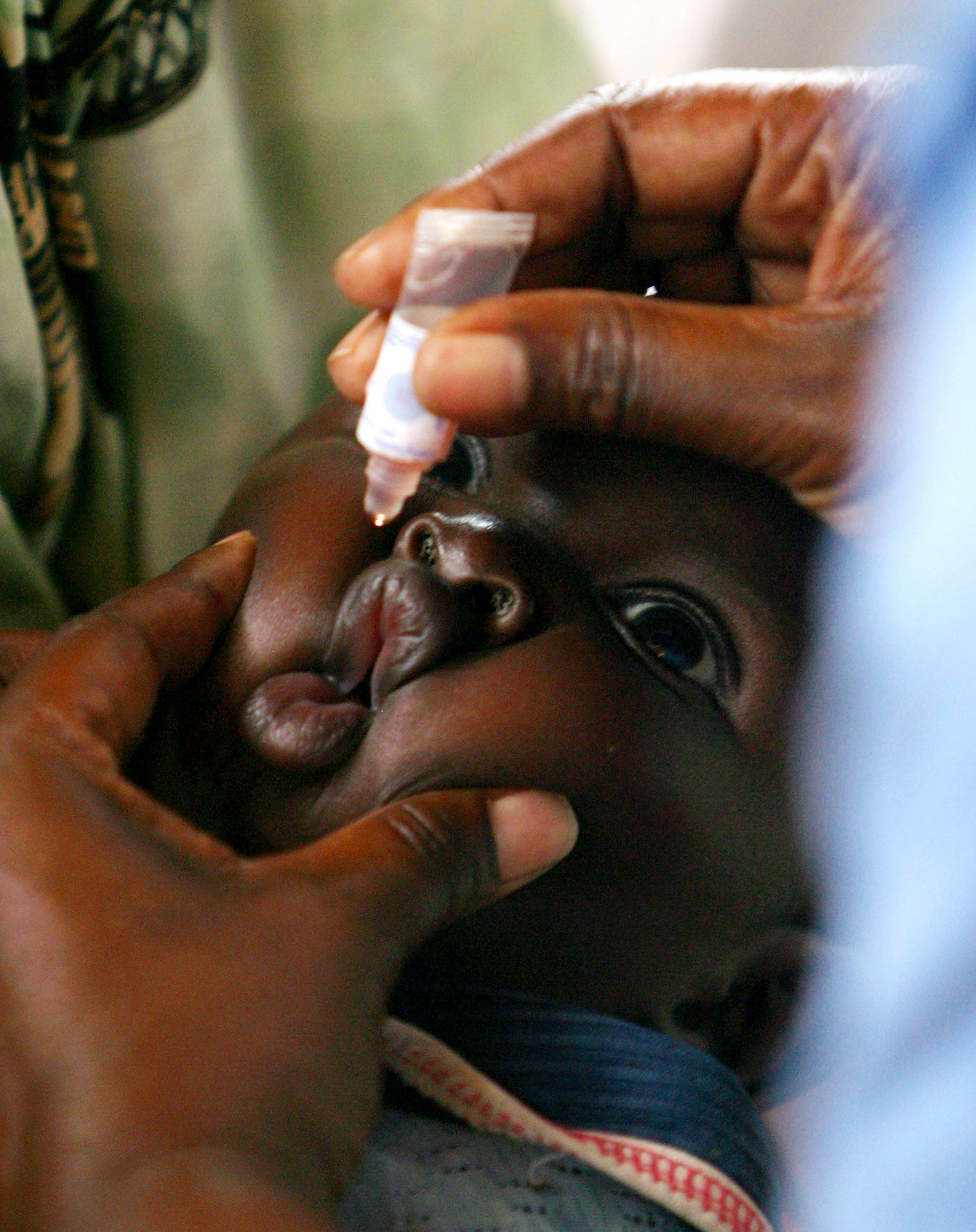 اللقاح الفموي وراء التفشي الجديد لشلل الأطفال في السودان
