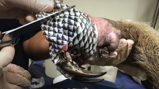 حروق الجلد: صور غير عادية لاستخدام جلد السمك في علاجها