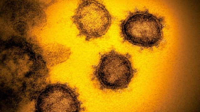 فيروس كورونا: الكشف عن علاقة جينات وراثية معينة بظهور أعراض إصابة شديدة بكوفيد-19