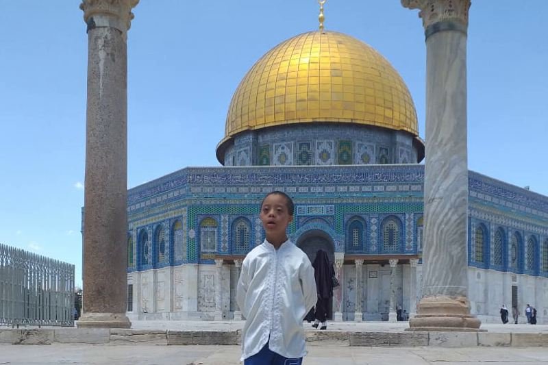 “تشوه في القلب” يقود الطفل المغربي يوسف للاستشفاء في إسرائيل