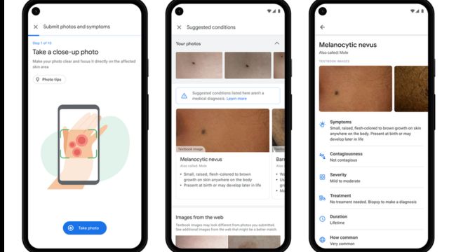 تطبيق جديد من غوغل يساعد على كشف الأمراض الجلدية