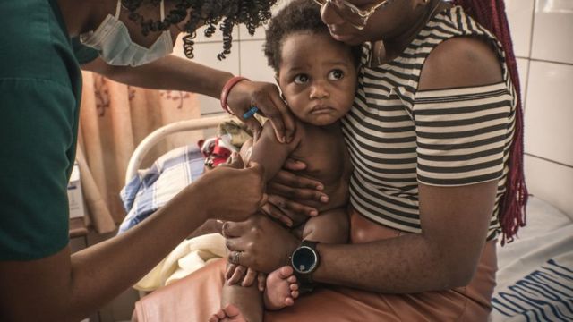 فيروس كورونا: الكونغو الديمقراطية تواجه مخاطر تفشي الحصبة بين الأطفال بسبب كوفيد