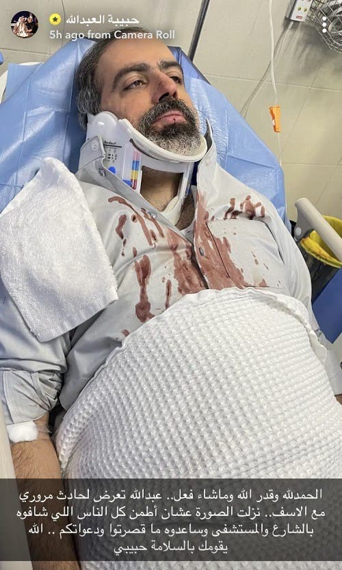 زوجته نشرت صورته ملطخا بالدماء.. إصابة فنان كويتي بحادث
