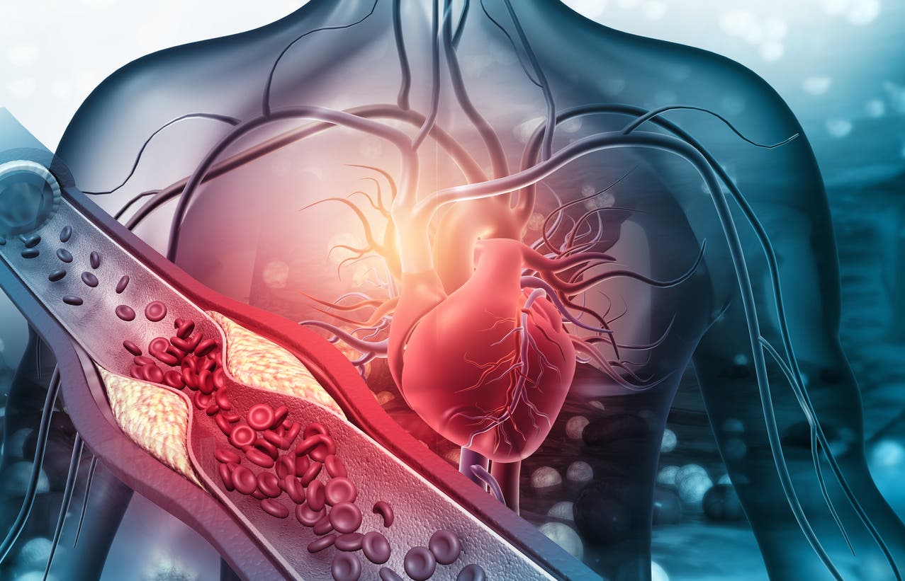 ليس كورونا.. الصحة العالمية تحذر من السبب الأول للوفاة حول العالم