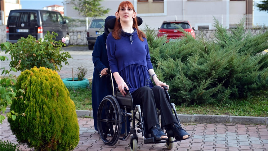 “أطول امرأة في العالم” التركية تخطط للسفر والتعرف على الثقافات