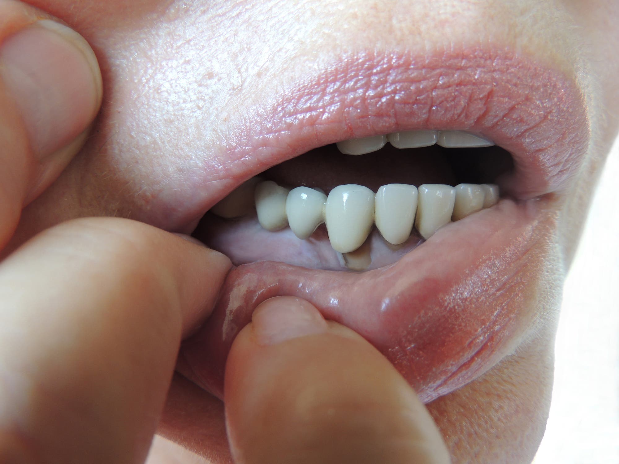 إياك إهمال صحة الفم.. دراسة تكشف مفاجأة مدوية!