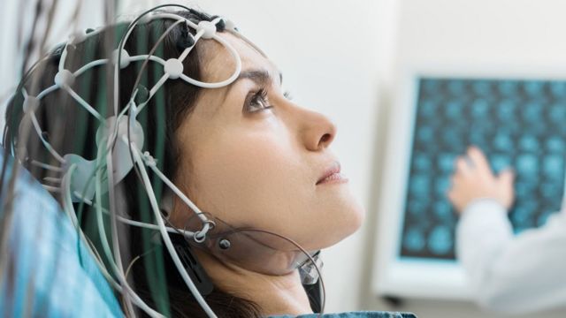 تجربة تكشف أن تحفيز الدماغ كهربائيا يقوي الذاكرة لمدة شهر