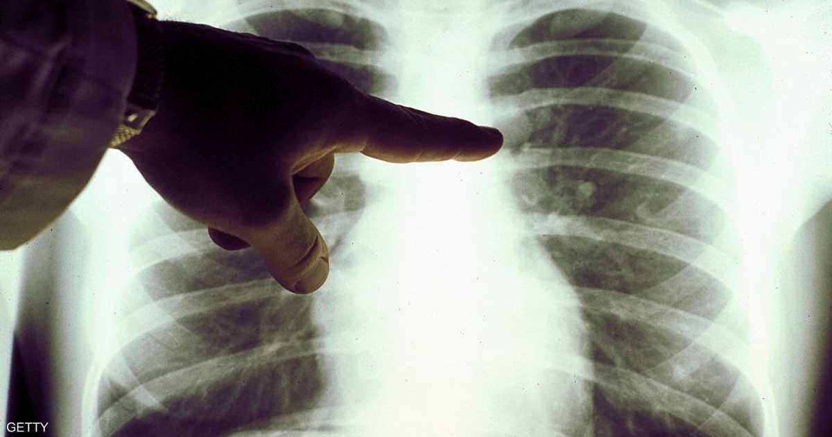 هل ظهر “مرض تنفسي جديد” في الصين؟ منظمة الصحة العالمية توضح
